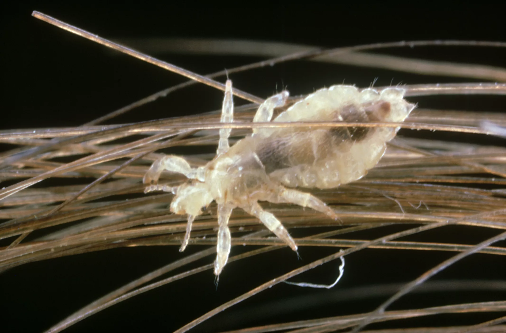 A close-up photo of a louse on hair
