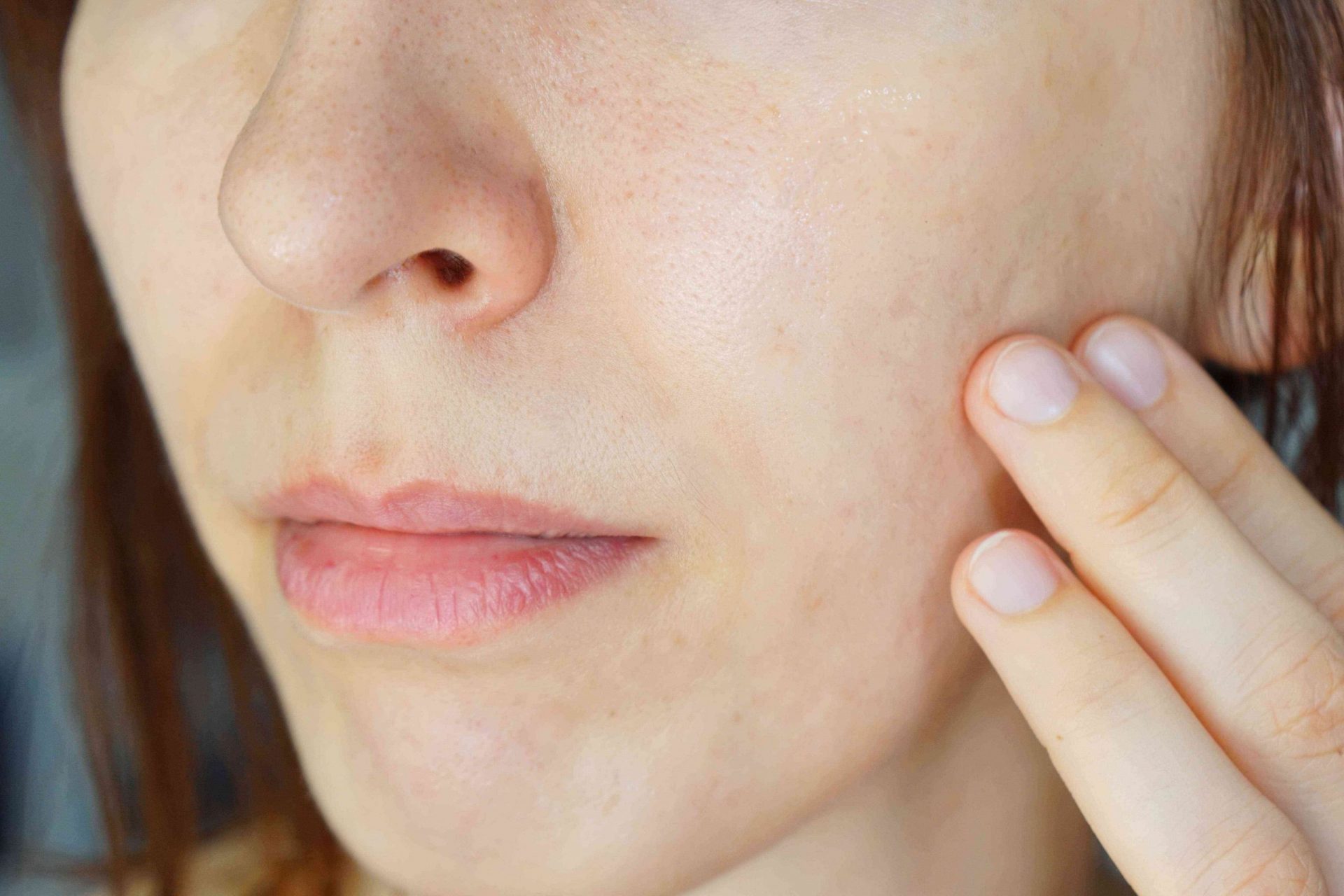 mujer frota manteca de karité en la mejilla para aliviar el eczema